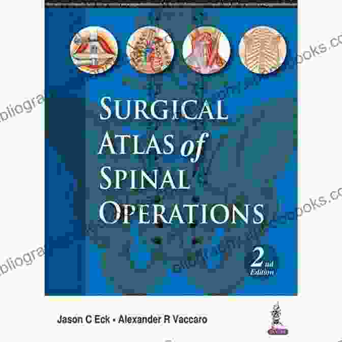 Surgical Atlas of Spinal Operations