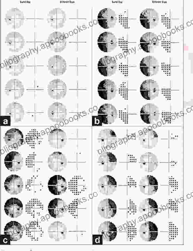 Visual Fields Manual Of Neuro Ophthalmology Deborah Brown